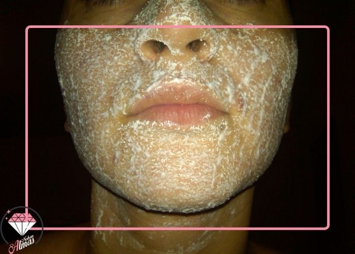 قرص آسپرین برای لک صورت - الماس نشان