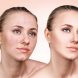 از هیدرودرمی یا آبرسانی پوست چه می دانید؟ از هیدرودرمی یا آبرسانی پوست چه می دانید؟