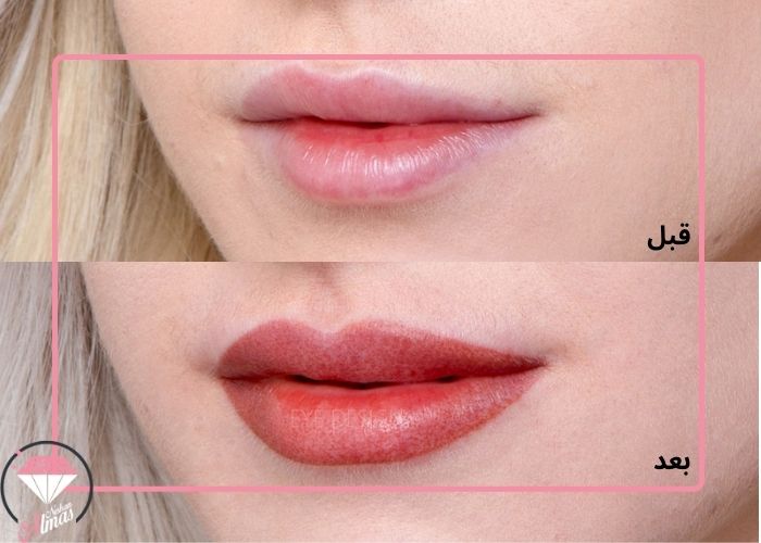 انواع مدل شیدینگ لب - سالن زیبایی الماس نشان 