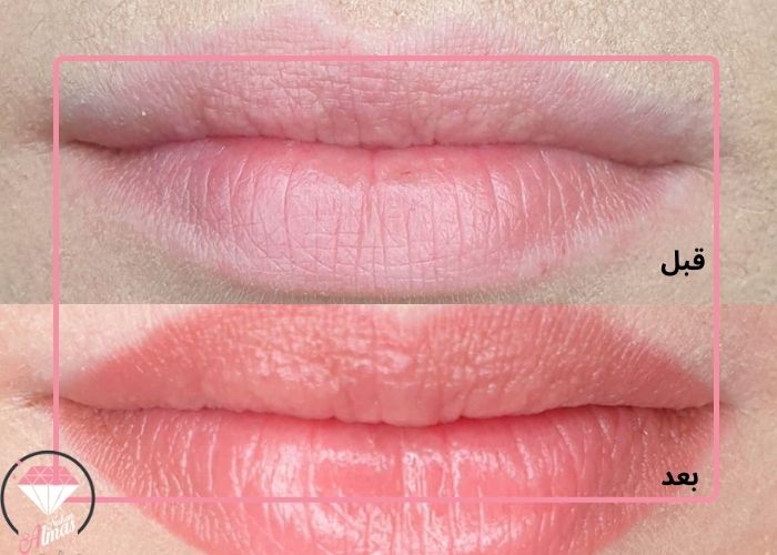 شیدینگ لب هلویی چیست؟ سالن زیبایی الماس نشان